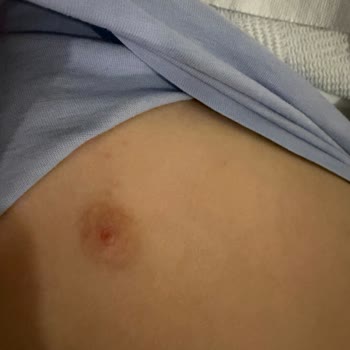 Marine Family Side Otelinde Hijyen Yoksunluğu Çocuğumu Hastalığa Sürükledi