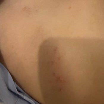 Marine Family Side Otelinde Hijyen Yoksunluğu Çocuğumu Hastalığa Sürükledi