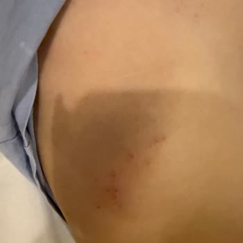 Marine Family Side Otelinde Hijyen Yoksunluğu Çocuğumu Hastalığa Sürükledi