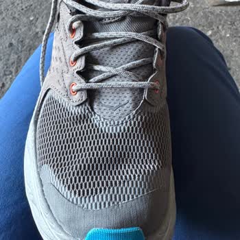 Intersport İç Topuk Deformasyonu Nedeniyle Garanti Reddi ve Tam İade Talebi