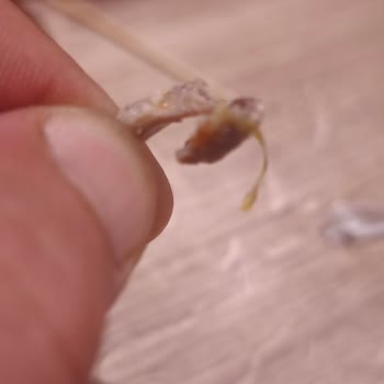 Burger Yiyelim Şubesinde Çocukta Kemik Parçası Bulundu