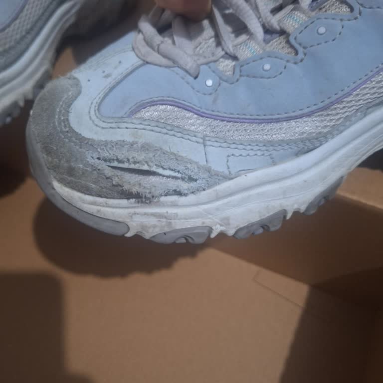 Skechers Ayakkabısının Altı Ayda Yırtılması Ve SuperStep İade Reddi