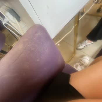 Ücretli Yapılmayan Jel Güçlendirme Ve Hijyen Eksikliği