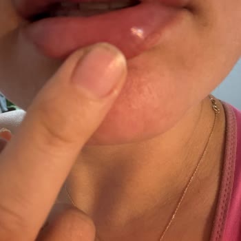 Maybelline Rujunda Şiddetli Tahriş Ve Yanma: İade Talebi