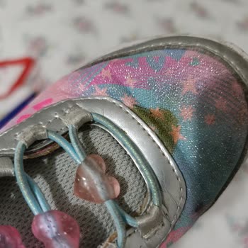 Skechers Çocuk Ayakkabısının Üç Ayda Deforme Olması Ve Garanti Reddi