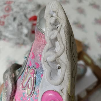 Skechers Çocuk Ayakkabısının Üç Ayda Deforme Olması Ve Garanti Reddi