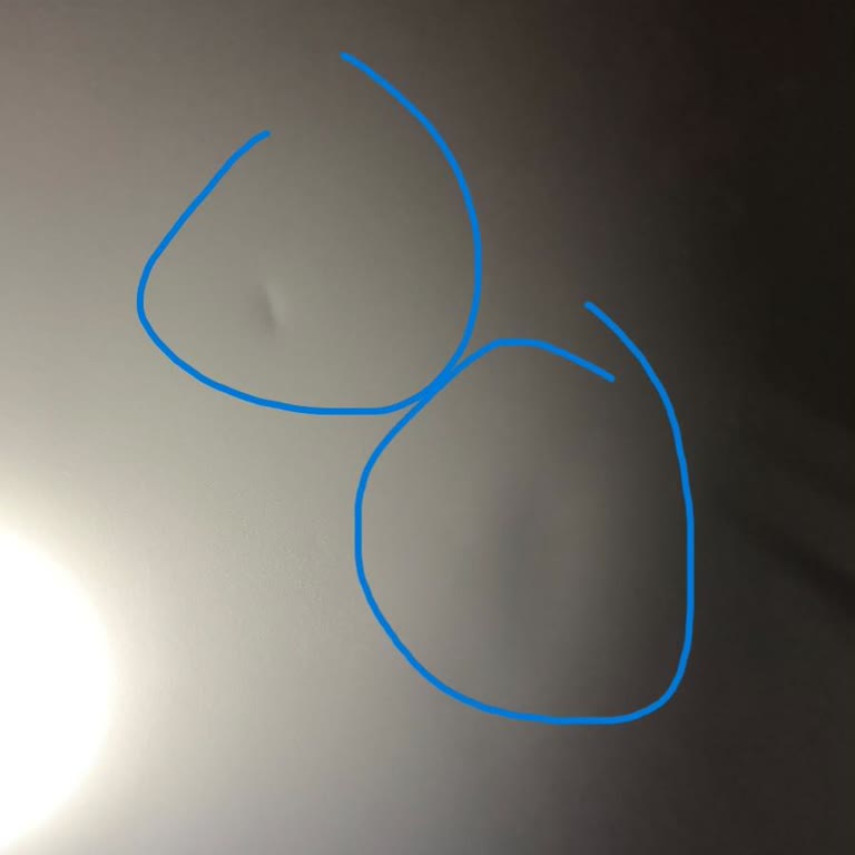 Profilo Taşıma Esnasında Kapakta Göçük, Tam Ürün Değişimi Talebi