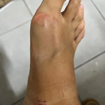 Birkenstock Terliği Sağlığıma Zarar Verdi, Tam Ücret İadesi Talebi