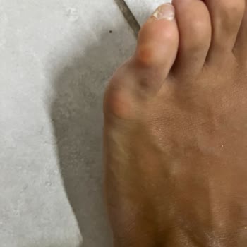 Birkenstock Terliği Sağlığıma Zarar Verdi, Tam Ücret İadesi Talebi