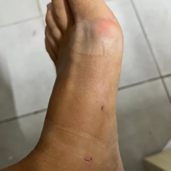 Birkenstock Terliği Sağlığıma Zarar Verdi, Tam Ücret İadesi Talebi
