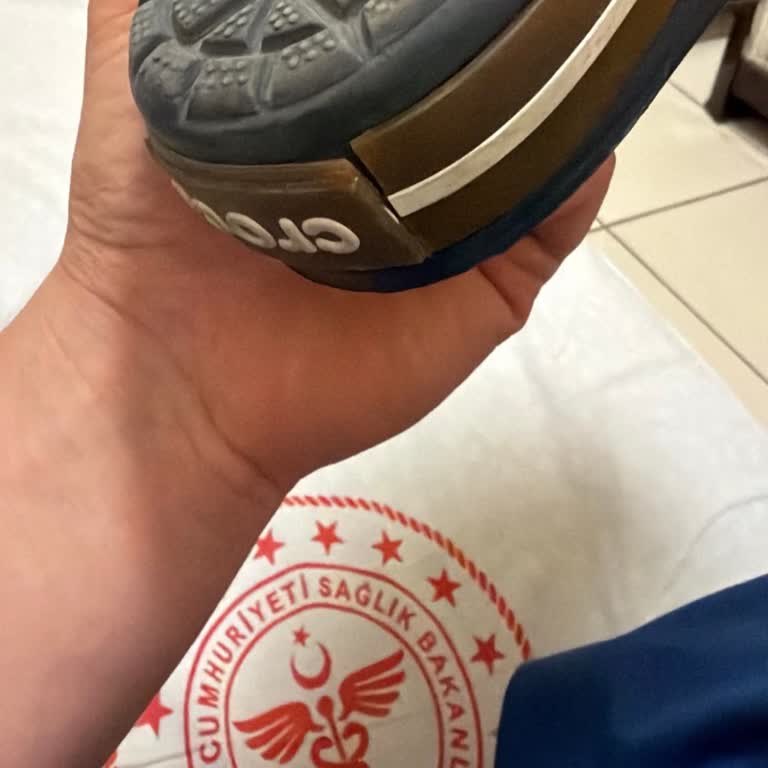 Crocs Terlikte Şerit Ayrılması Ve Müşteri Hizmetlerinden Olumsuz Cevap