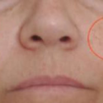 Cire Aseptine Güneş Kremi Lekeleri Artırdı, İade İstiyorum