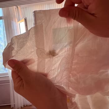 Bebek Bezinde Yabancı Cisim Ve Molfix’ten Cevapsızlık
