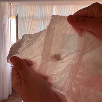 Bebek Bezinde Yabancı Cisim Ve Molfix’ten Cevapsızlık