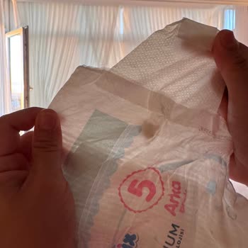 Bebek Bezinde Yabancı Cisim Ve Molfix’ten Cevapsızlık