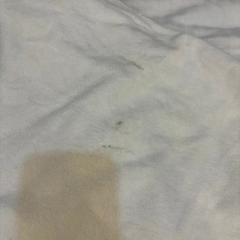 Arçelik Çamaşır Makinesi Lekeleri Ve Tazminat İhmaline Yönelik Şikayet