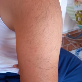 Cb Golden Life 9 Seansa Girmeme Rağmen Tüylerimde Beklediğim Hiçbir Azalmayı Göremedim