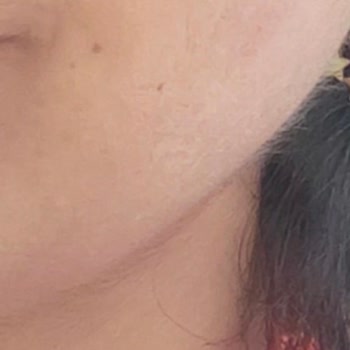 Koza Beauty & Care Marmaris Yanlış Uygulama Yüzünden Kıllarımda Artış Oldu