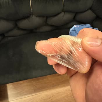 Gratis Durex Prezervatiflerinde Yırtılma Ve Gebelik Riski