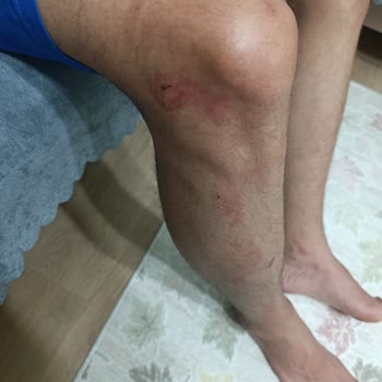 Otel Müdürünün Eşimi Ve Çocuğumu Darp Etmesi