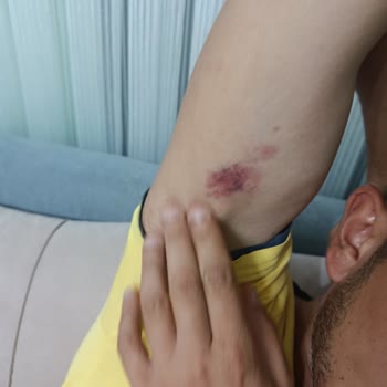 Otel Müdürünün Eşimi Ve Çocuğumu Darp Etmesi