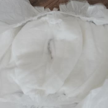 Bebek Bezi İçindeki Siyah Parça Nedeniyle Sağlık Endişesi Ve İade Talebi
