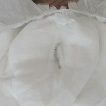 Bebek Bezi İçindeki Siyah Parça Nedeniyle Sağlık Endişesi Ve İade Talebi