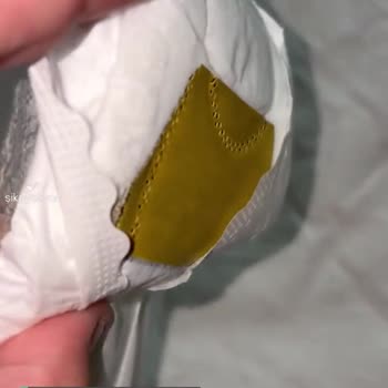 Molped Pedde Yabancı Madde Varlığı