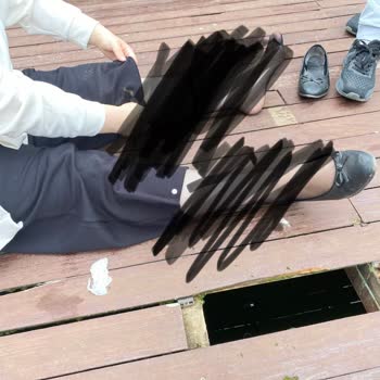 Zemin Çatlağından Bacak Kırılması Ve Otel Personelinin Umursamaz Tutumu