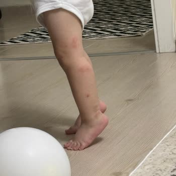 Siveno Losyonu Çocuğumda Sivrisinek Isırıkları Oluşturdu