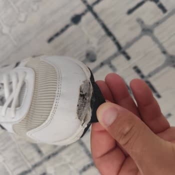 Ayakkabı Açılmaları Sonrası Garanti Reddi Ve Kullanıcı Hatası İddiası