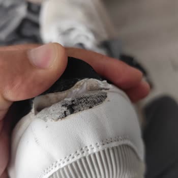 Ayakkabı Açılmaları Sonrası Garanti Reddi Ve Kullanıcı Hatası İddiası