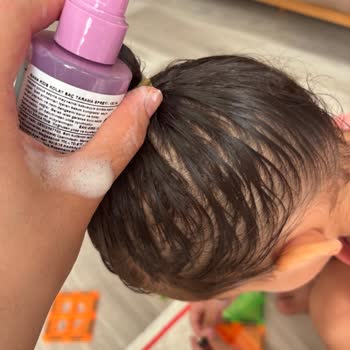 Rossmann'dan Aldığım Çocuk Spreyi Saçta Köpürerek Sağlık Korkusu Yaratıyor