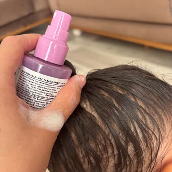 Rossmann'dan Aldığım Çocuk Spreyi Saçta Köpürerek Sağlık Korkusu Yaratıyor