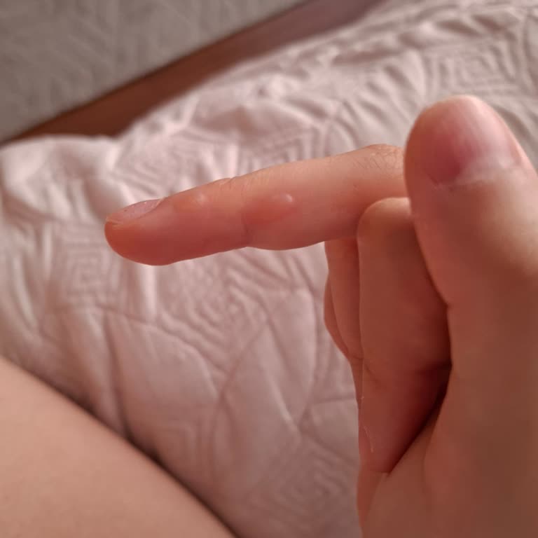 Uyarısız Markasız Boraks Ürününün Cilt Reaksiyonu Ve Satışının Durdurulması Talebi