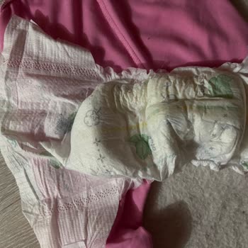 Prima Bebek Bezi 2 Saatte Sızdırması Ve İade Talebi