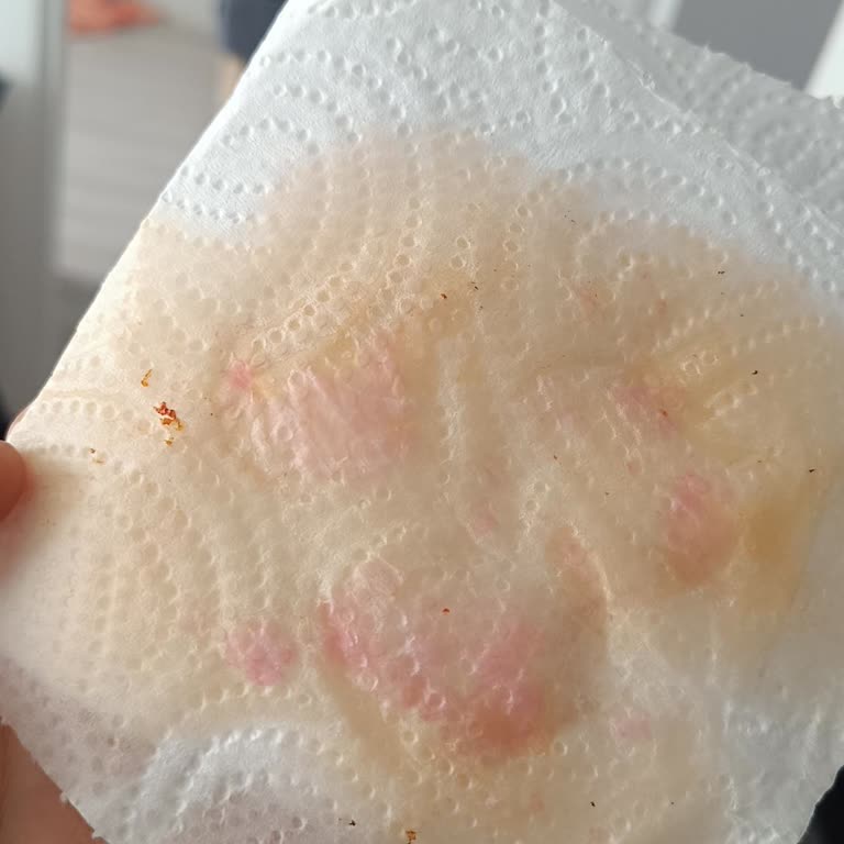Renk Salan Sucukta Cevapsızlık Ve İade Talebi