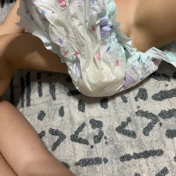 Ebebek Pofy Bebek Bezinde Topaklanma Oluyor