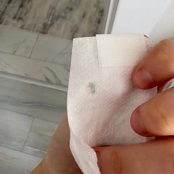 Molfix Bebekte Böcek Ölüsü Tespit Edildi, Hijyen Güvensizliği
