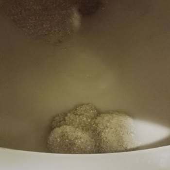 Kochler Otomatik Kedi Tuvaletinde Koku Ve Sızıntı, Servisin İade Yaklaşımı Çözüm Getirmedi