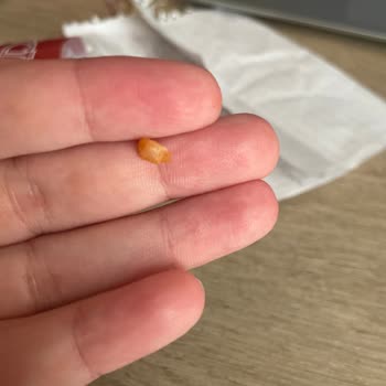 BİM Mantısında Sert Taş Benzeri Yabancı Madde Bulundu