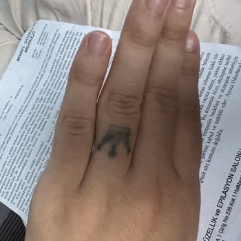 Söz Verilen Dövme Silme İşleminde Hiç Sonuç Alınmadı Ve Ücret İadesi Talebi