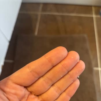I Face Kotex Ultra Normal Pad Quality Issues After Gel-Like Particles Stuck To My Skin