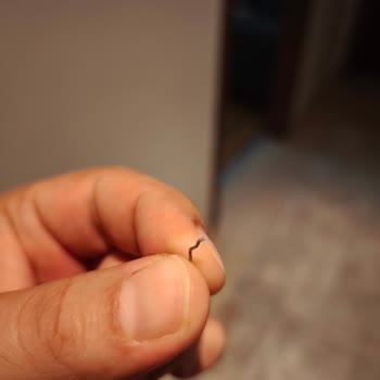 Bebek Ununda Metal Parça Bulunması Güven Krizi