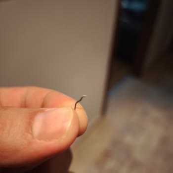 Bebek Ununda Metal Parça Bulunması Güven Krizi