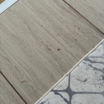 Trendyol’da Satın Alınan Özdilek Bornozlarda Boya Akması Ve Tüy Sorunu, İade Reddi