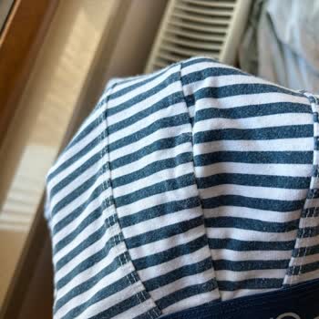 Renk Atlama Ve Tüylenme Sorunu Yaşadığım Kalitesiz Boxer