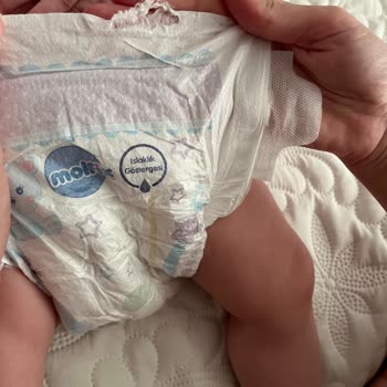 Molfix Bebek Bezinde Üst Kısmı Yırtık Güven Sorunu Ve İnceleme Talebi