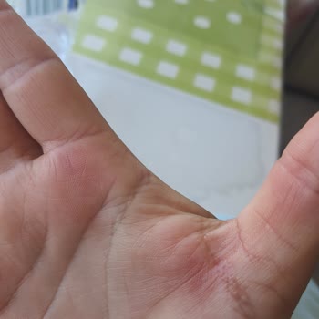 Kapak Aşırı Sert, Şişe Deforme Oluyor Ve Su Fışkırıyor