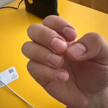Senem Alp Güzellik Merkezi Dikkatsiz ve Sağlıksız Bir Uygulama